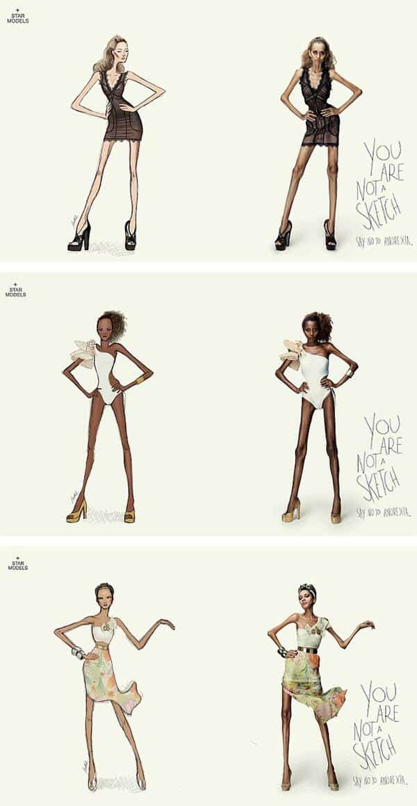 say no to anorexia